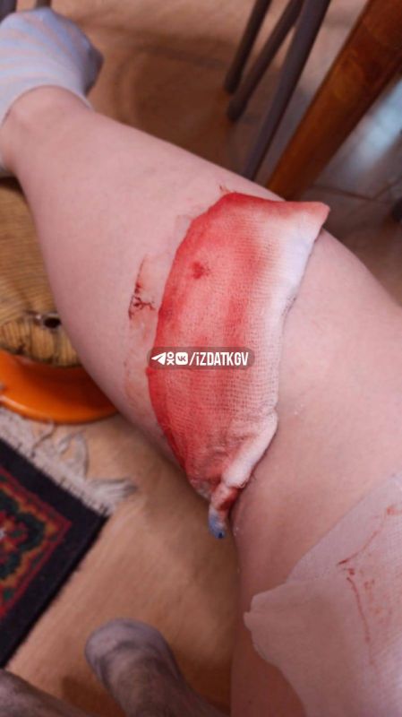 Стая бродячих собак терроризирует детей и взрослых на Глаголева в Калуге