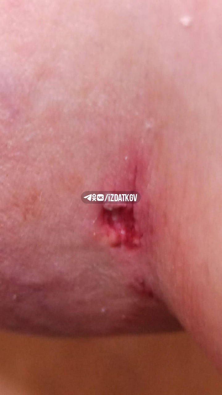 Стая бродячих собак терроризирует детей и взрослых на Глаголева в Калуге Стая бродячих собак терроризирует детей и взрослых на Глаголева в Калуге