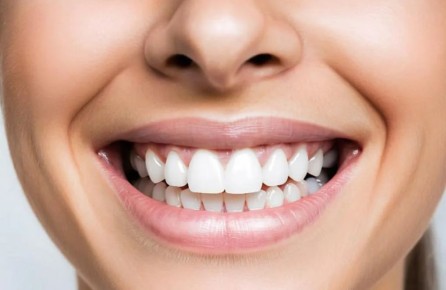 Калужанка осталась недовольна профессиональной чисткой зубов