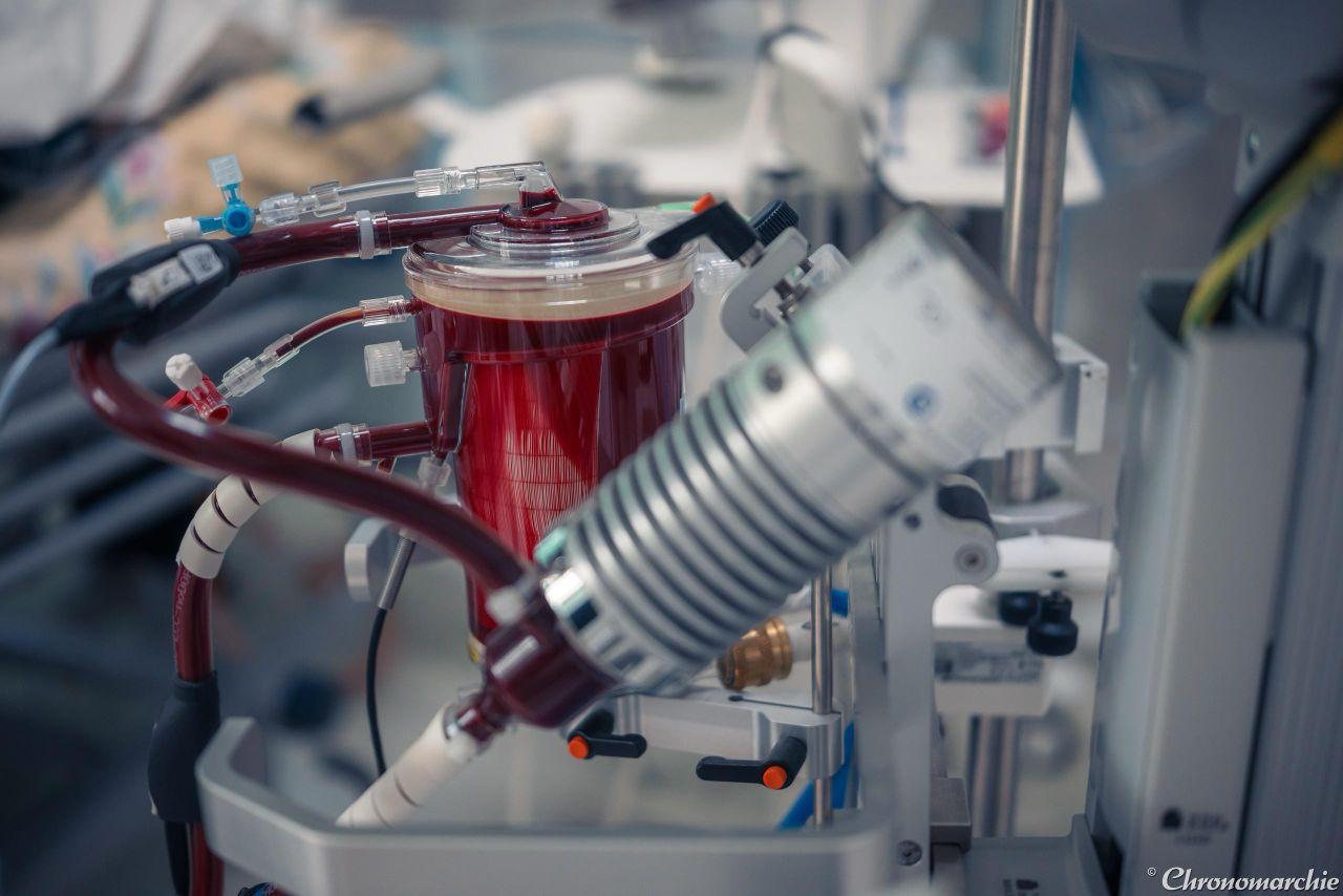 Пациентов с тяжелейшими травмами спасают в Калужской области с помощью технологии ЭКМО Пациентов с тяжелейшими травмами спасают в Калужской области с помощью технологии ЭКМО