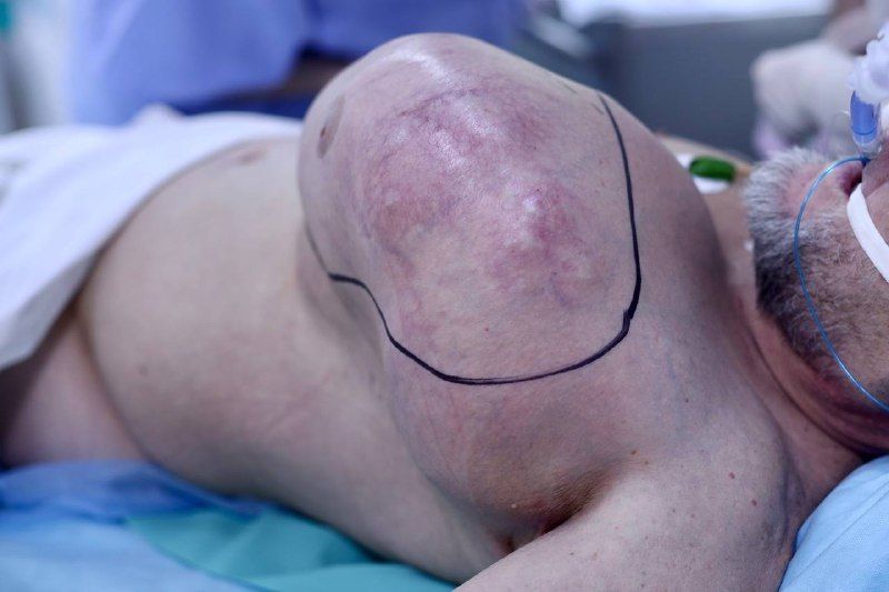 �������� ������� ������� ������� � ��������