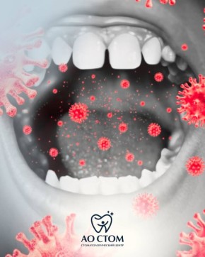 Почему регулярная гигиена полости рта — это ключ к здоровью зубов