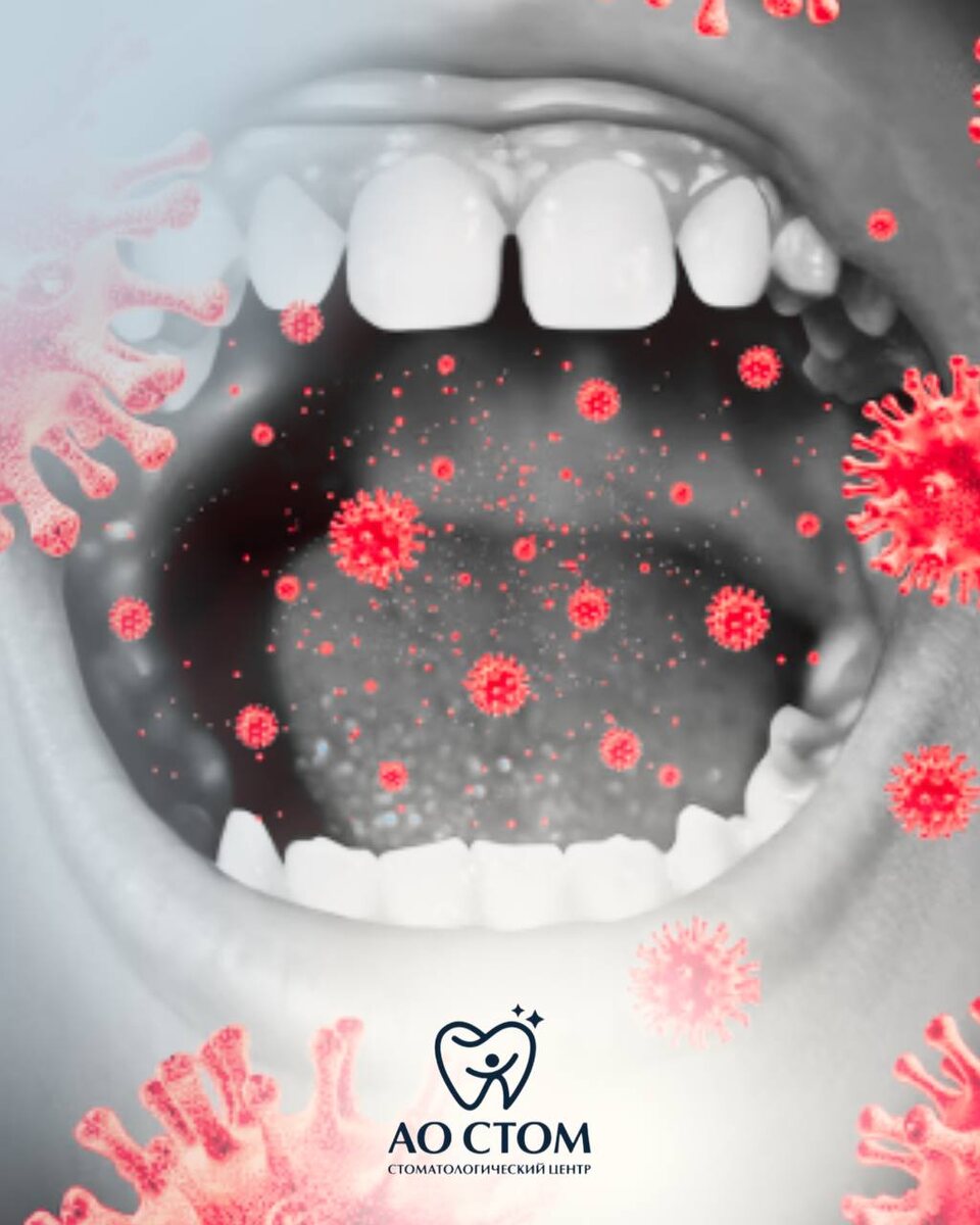 Почему регулярная гигиена полости рта — это ключ к здоровью зубов