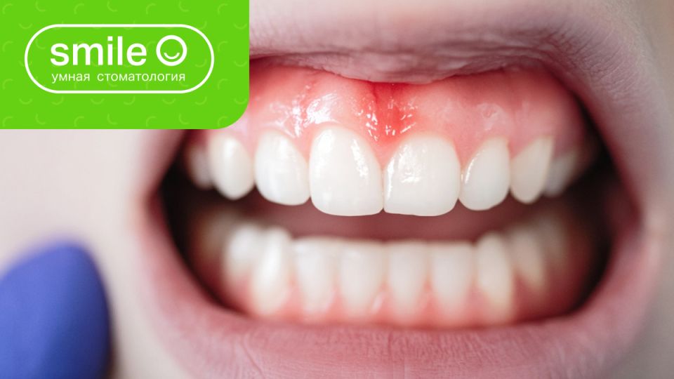 ����� ����� �� ������: ����� ����� ���� �������?