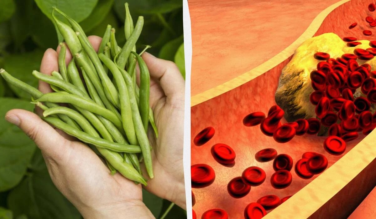 Зеленая фасоль: натуральный способ борьбы с высоким холестерином