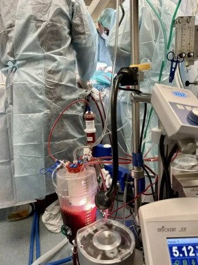 Калужские врачи применили новейшую технологию, чтобы спасти жизнь человеку